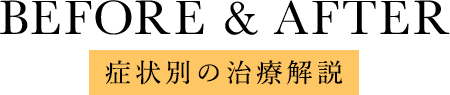 治療解説